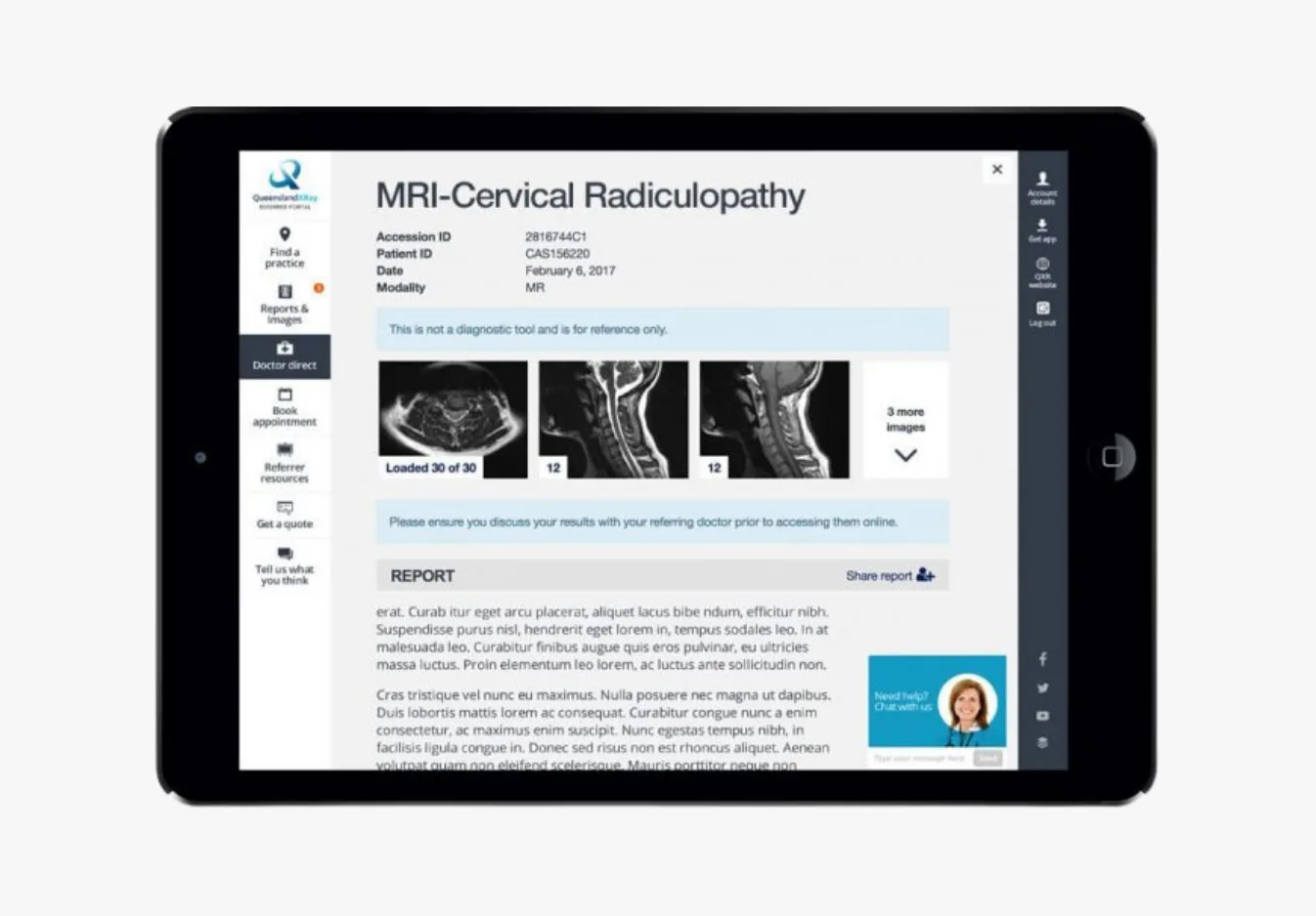 Tablet displaying an MRI cervical radiculopathy medical report with patient details, three MRI spine images showing cross-sectional and sagittal views, clinical report text, and a chat feature with...
